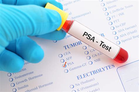 psa blood test bottle|psa micrograms per litre.